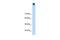 Transient Receptor Potential Cation Channel Subfamily M Member 3 antibody, GTX47533, GeneTex, Western Blot image 