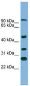 Aspartate Beta-Hydroxylase antibody, TA343455, Origene, Western Blot image 