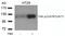 Protein Tyrosine Kinase 2 antibody, PA5-37706, Invitrogen Antibodies, Western Blot image 