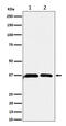 Serine Racemase antibody, M02660-1, Boster Biological Technology, Western Blot image 