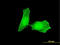 Checkpoint Kinase 1 antibody, LS-C196906, Lifespan Biosciences, Immunofluorescence image 