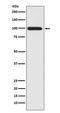 LDL Receptor Related Protein 1 antibody, M00829, Boster Biological Technology, Western Blot image 