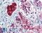 Peroxisome Proliferator Activated Receptor Gamma antibody, LS-B3892, Lifespan Biosciences, Immunohistochemistry frozen image 