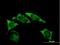 Insulin Like Growth Factor 2 MRNA Binding Protein 2 antibody, H00010644-B01P, Novus Biologicals, Immunofluorescence image 