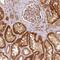 Methylenetetrahydrofolate Dehydrogenase (NADP+ Dependent) 1 Like antibody, PA5-56046, Invitrogen Antibodies, Immunohistochemistry paraffin image 
