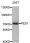 Pescadillo Ribosomal Biogenesis Factor 1 antibody, abx004584, Abbexa, Western Blot image 