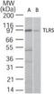Toll Like Receptor 5 antibody, MA5-16233, Invitrogen Antibodies, Western Blot image 