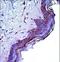 CD1a Molecule antibody, LS-C168517, Lifespan Biosciences, Immunohistochemistry paraffin image 