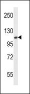 Fibroblast Growth Factor Receptor 2 antibody, PA1-31990, Invitrogen Antibodies, Western Blot image 
