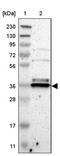 Transmembrane BAX Inhibitor Motif Containing 1 antibody, PA5-52909, Invitrogen Antibodies, Western Blot image 