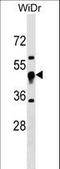 Ubiquinol-Cytochrome C Reductase Core Protein 1 antibody, LS-C157331, Lifespan Biosciences, Western Blot image 