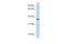 Transmembrane Protein 200B antibody, A18559, Boster Biological Technology, Western Blot image 