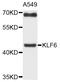 Kruppel Like Factor 6 antibody, abx135929, Abbexa, Western Blot image 