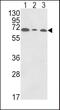 Polymeric Immunoglobulin Receptor antibody, PA5-35340, Invitrogen Antibodies, Western Blot image 