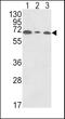 Polymeric Immunoglobulin Receptor antibody, PA5-35340, Invitrogen Antibodies, Western Blot image 