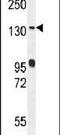 DENN Domain Containing 5A antibody, PA5-24015, Invitrogen Antibodies, Western Blot image 