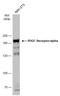 Platelet Derived Growth Factor Receptor Alpha antibody, GTX133620, GeneTex, Western Blot image 