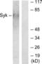 Spleen Associated Tyrosine Kinase antibody, LS-C118582, Lifespan Biosciences, Western Blot image 