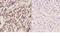 Kruppel Like Factor 11 antibody, A04277-1, Boster Biological Technology, Immunohistochemistry paraffin image 