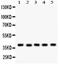 Snail Family Transcriptional Repressor 1 antibody, LS-C357587, Lifespan Biosciences, Western Blot image 