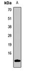 Insulin Like 3 antibody, LS-C667887, Lifespan Biosciences, Western Blot image 