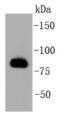 G Protein-Coupled Receptor Kinase 2 antibody, NBP2-67542, Novus Biologicals, Western Blot image 