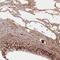 Fibrinogen Alpha Chain antibody, NBP2-49424, Novus Biologicals, Immunohistochemistry paraffin image 