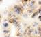 Junction Plakoglobin antibody, PB9185, Boster Biological Technology, Immunocytochemistry image 