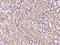 Dynactin Subunit 6 antibody, 200717-T08, Sino Biological, Immunohistochemistry paraffin image 