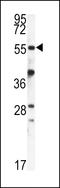 Peptidyl-prolyl cis-trans isomerase FKBP1B antibody, LS-C100579, Lifespan Biosciences, Western Blot image 