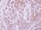 TEK Receptor Tyrosine Kinase antibody, NBP2-20636, Novus Biologicals, Immunohistochemistry frozen image 