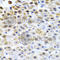 Tissue Factor Pathway Inhibitor 2 antibody, A6214, ABclonal Technology, Immunohistochemistry paraffin image 