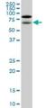 Nucleolar And Coiled-Body Phosphoprotein 1 antibody, H00009221-M01, Novus Biologicals, Western Blot image 