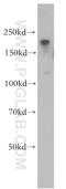 Terminal Uridylyl Transferase 4 antibody, 18980-1-AP, Proteintech Group, Western Blot image 