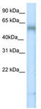 T-box transcription factor TBX6 antibody, TA333968, Origene, Western Blot image 