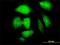 Necdin, MAGE Family Member antibody, H00004692-M02, Novus Biologicals, Immunocytochemistry image 