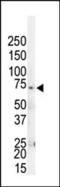 G Protein-Coupled Receptor Kinase 4 antibody, 62-584, ProSci, Western Blot image 