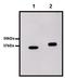 Glutathione-S-Transferase Tag antibody, NBP2-37824, Novus Biologicals, Western Blot image 