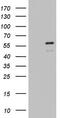 Zinc Finger And BTB Domain Containing 37 antibody, M16043, Boster Biological Technology, Western Blot image 