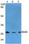 Kallikrein Related Peptidase 4 antibody, PA5-75732, Invitrogen Antibodies, Western Blot image 