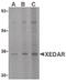 Ectodysplasin A2 Receptor antibody, PA5-20230, Invitrogen Antibodies, Western Blot image 