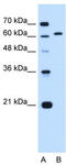 Lamin B2 antibody, TA339371, Origene, Western Blot image 