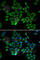 NFKB Inhibitor Beta antibody, A5777, ABclonal Technology, Immunofluorescence image 