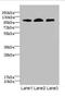 EPH Receptor B4 antibody, LS-C675715, Lifespan Biosciences, Western Blot image 