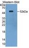 Lactate Dehydrogenase D antibody, LS-C695166, Lifespan Biosciences, Western Blot image 