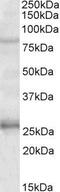 GPRIN Family Member 3 antibody, GTX88035, GeneTex, Western Blot image 