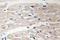 Integrin Subunit Beta 1 antibody, LS-C176320, Lifespan Biosciences, Immunohistochemistry paraffin image 