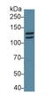 Signal Transducer And Activator Of Transcription 2 antibody, LS-C710365, Lifespan Biosciences, Western Blot image 