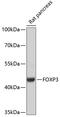 FOXP3 antibody, GTX64343, GeneTex, Western Blot image 