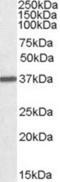 Arginase 1 antibody, NBP1-36936, Novus Biologicals, Western Blot image 